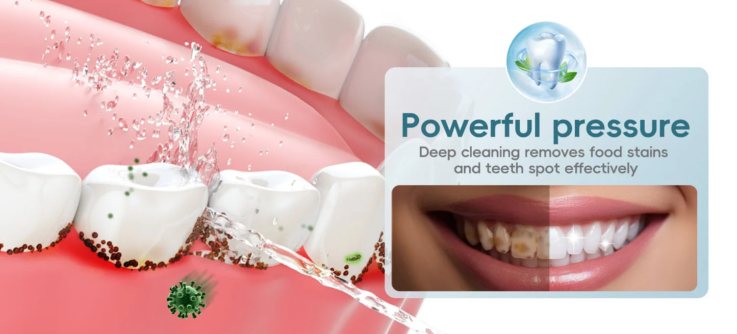 Dental Oral Irrigator Water Flosser